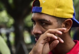 Portal 180 - Violinista de protestas contra Maduro dice que fue torturado en prisión