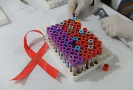 Portal 180 - Nuevos diagnósticos anuales de VIH bajaron levemente en 2020
