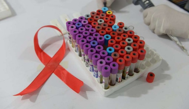 Nuevos diagnósticos anuales de VIH bajaron levemente en 2020