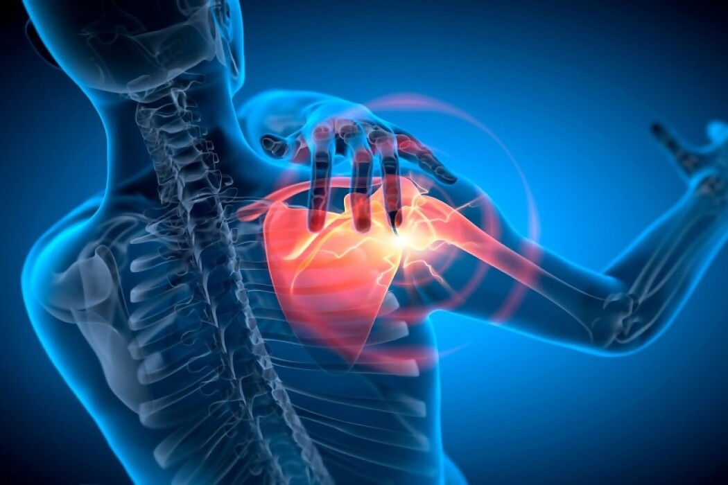 El hombro, el dolor y el famoso manguito rotador — DelSol | Del Sol 99.5 en el Mundial Rusia 2018