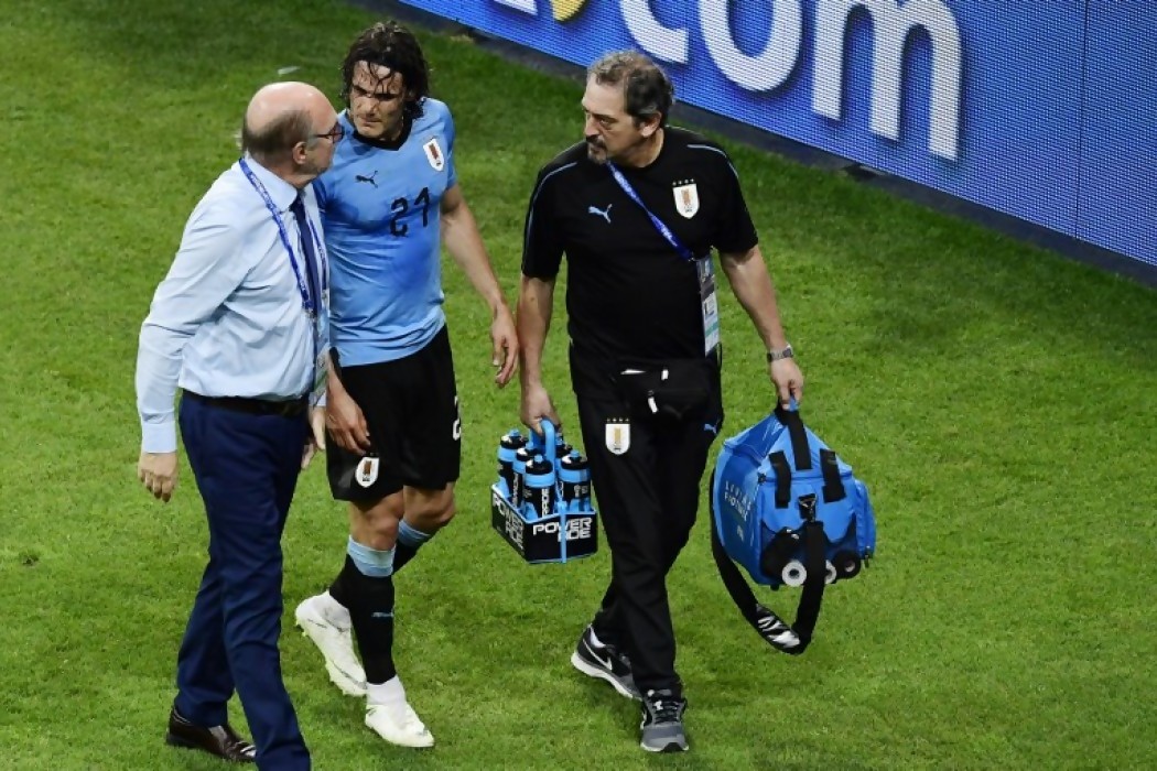 La lesión de Cavani y cómo podría tratarse — Sol | Del Sol 99.5 en el Mundial Rusia 2018