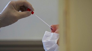 Datos sugieren diferencias en intensidad de monitoreo de Covid según nivel socioeconómico - Informes - DelSol 99.5 FM