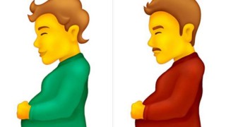 Curiosidades del cuerpo humano - Segmento humorístico - DelSol 99.5 FM