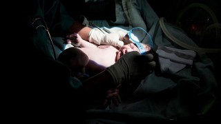 Las cesáreas vienen en aumento y alcanzaron el 48% del total de nacimientos - Informes - DelSol 99.5 FM