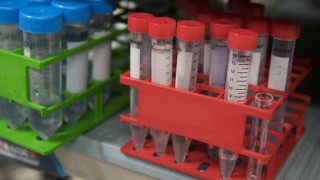 Otro caso exitoso de cáncer curado con las defensas del paciente - Informes - DelSol 99.5 FM