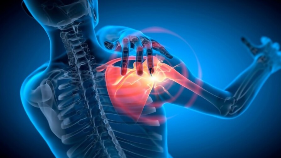 El hombro, el dolor y el famoso manguito rotador - Gastón Gioscia - No Toquen Nada | DelSol 99.5 FM